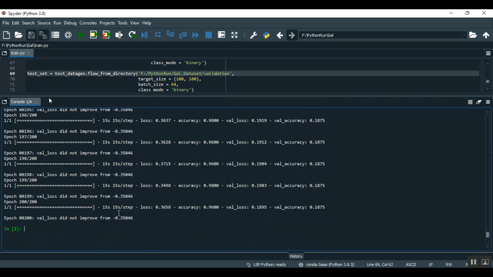 Glaucoma Disease Prediction Image Classification Streamlit in Python ...