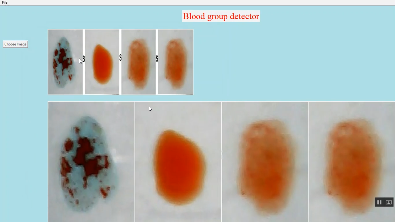 Blood Group Detection in Python Projects