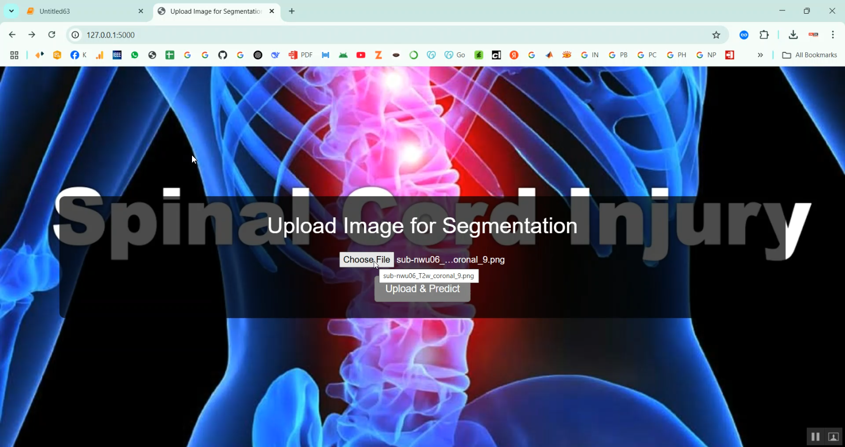 Spinal Cord Injury Detection in Python Projects