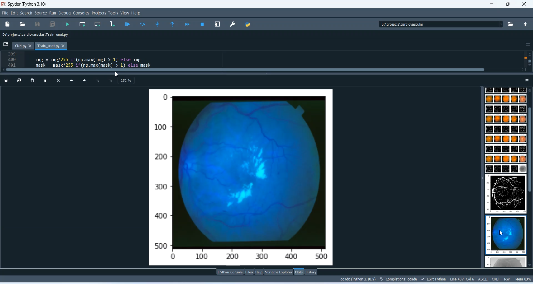 Cardiovascular Disease Classification in Python Projects