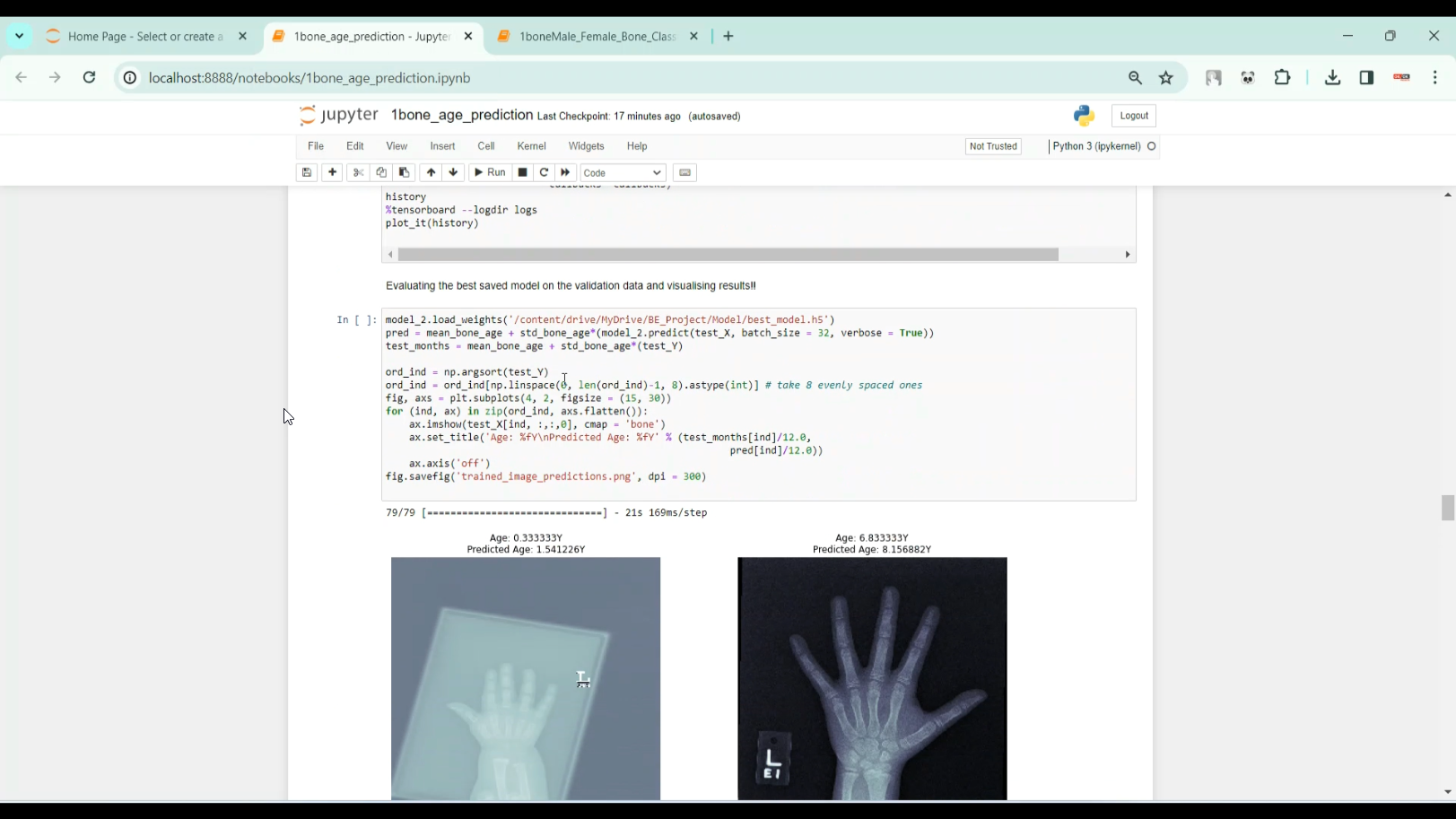 Bone Age Prediction in Python Projects