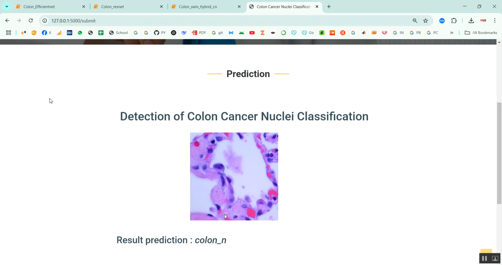 Colon Cancer Nuclei Classification in Python Projects