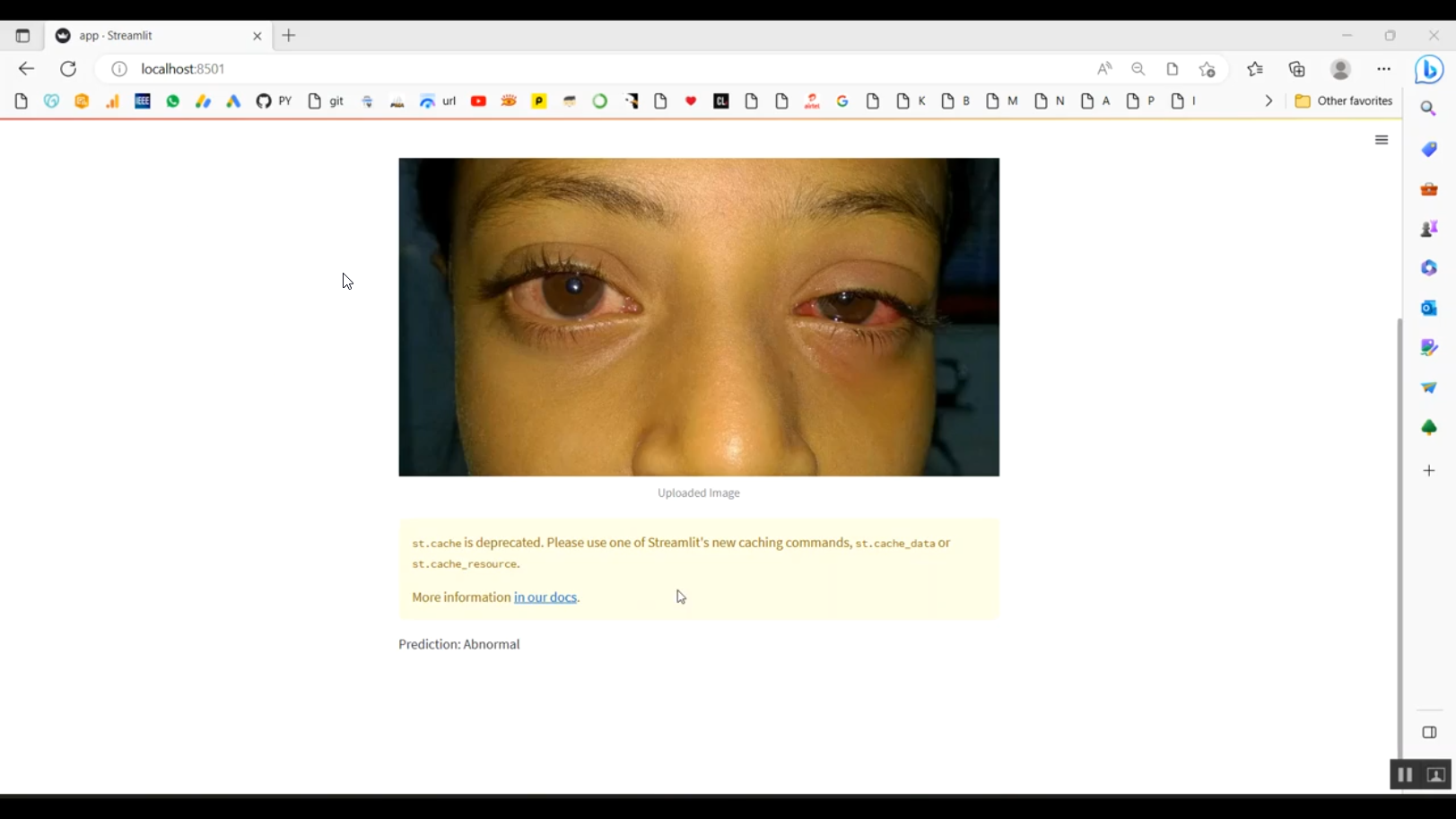 Face Normal Abnormal Classification Streamlit in Python Projects