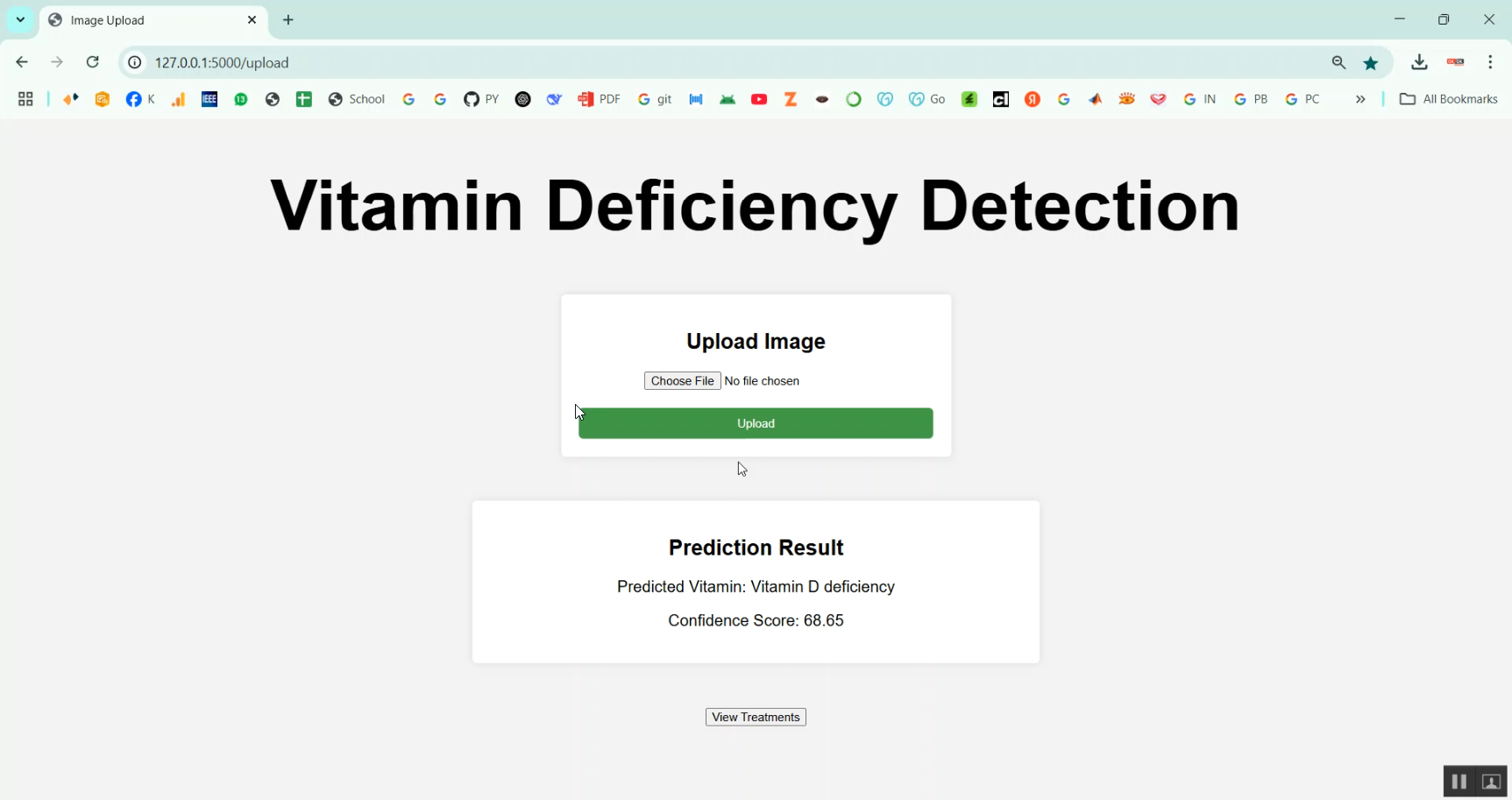 Vitamin Deficiency Detection Using Image Processing in Python Projects