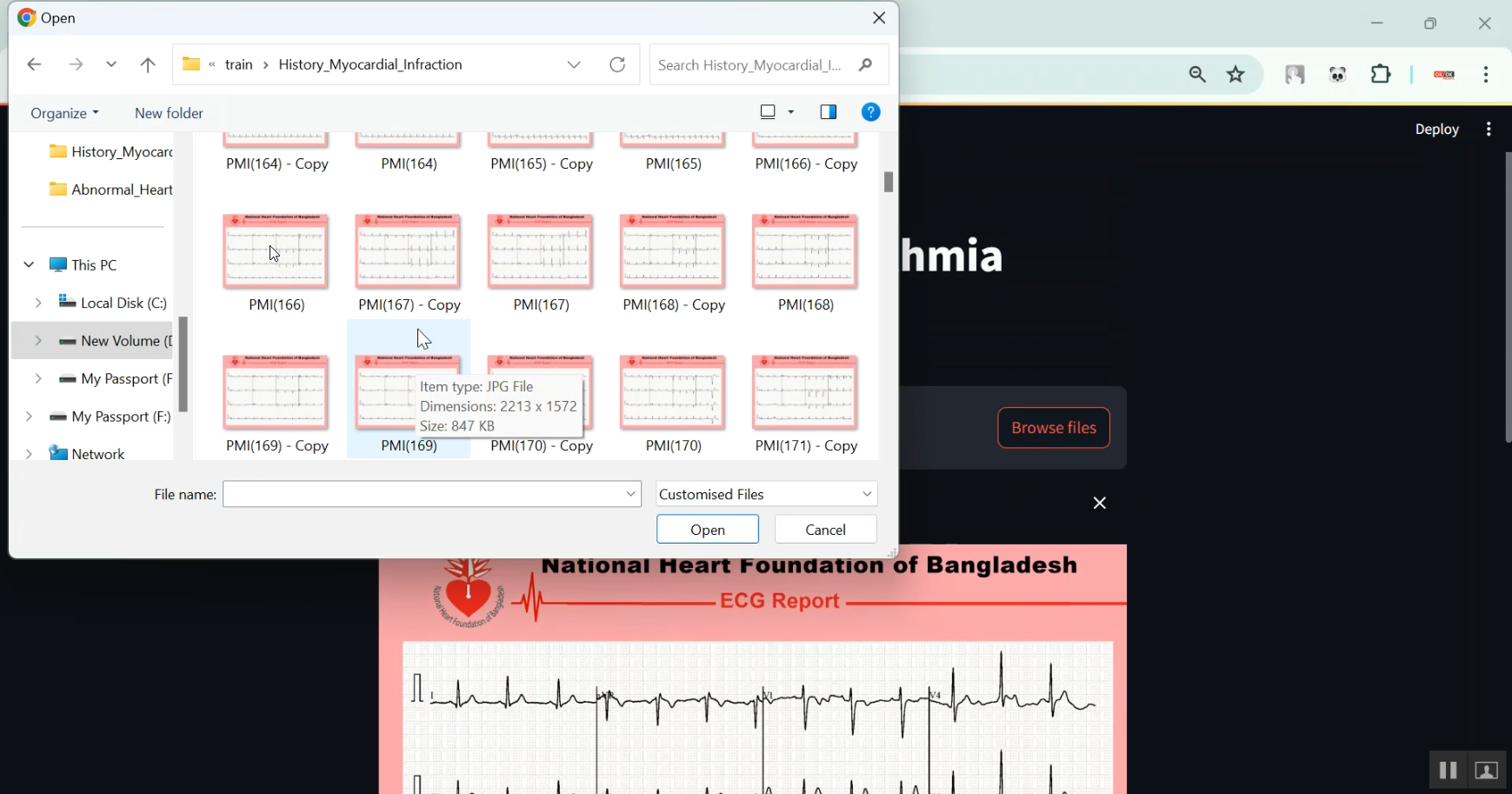 Cardiac Arrhythmia Classification in Python Projects