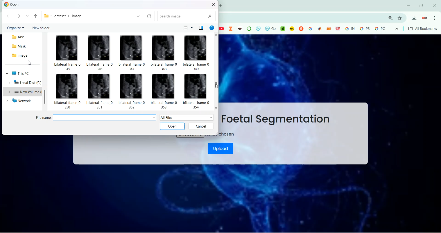 Foetal Segmentation using Image in Python Projects