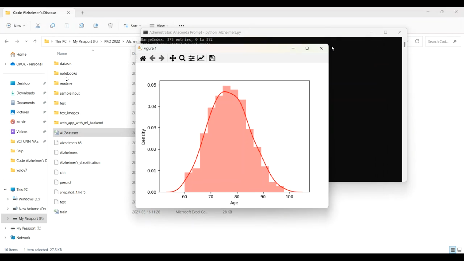 Alzheimer Early Detection CNN MLP in Python Projects