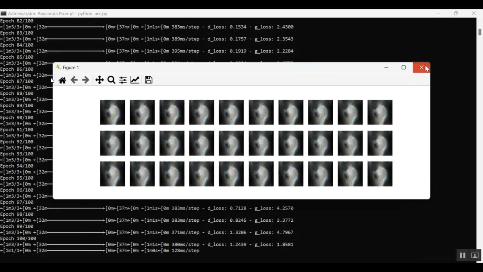 Bone Catolico Classification in Python Projects