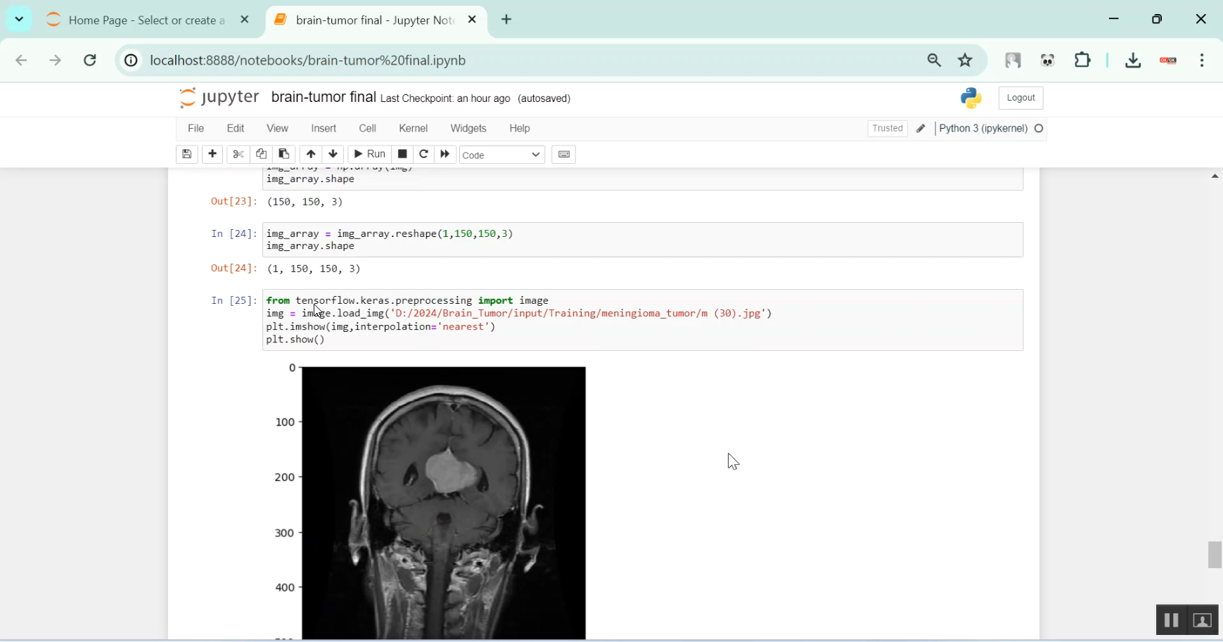 Brain Tumor Detection Analyze and Classification in Python Projects