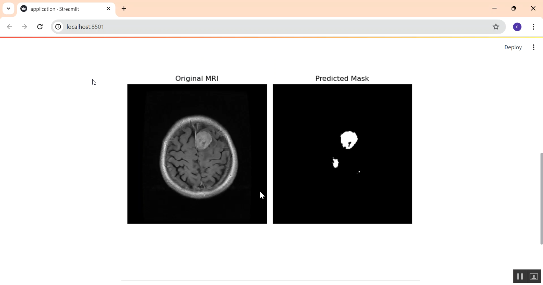 Brain MRI image Segmentation in Python Projects
