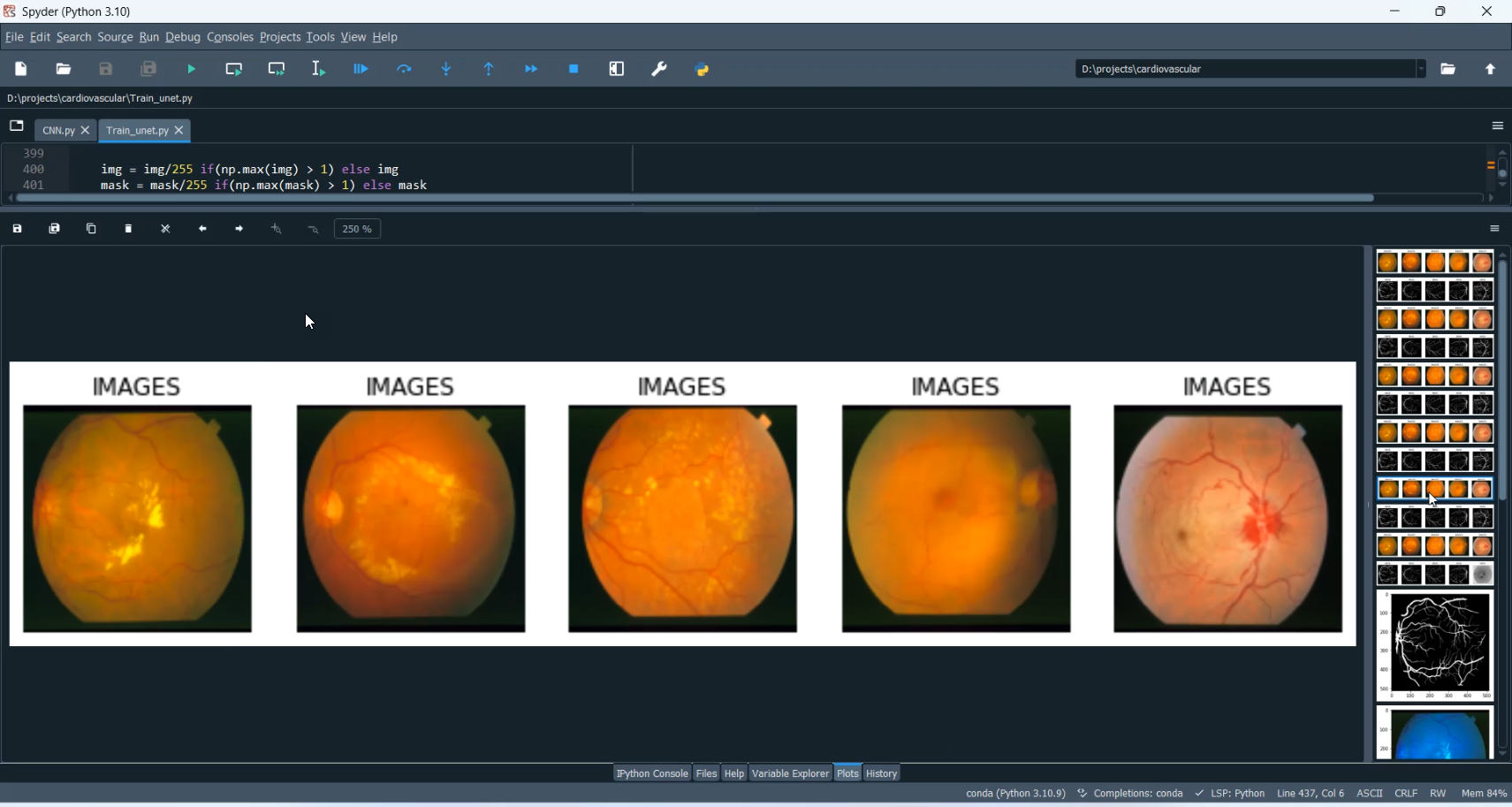 Cardiovascular Disease Classification in Python Projects