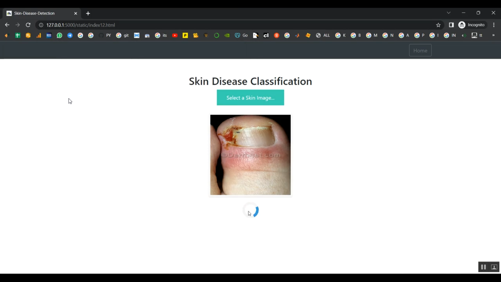 Data Skin Skin Disease Detection Train Image Data Flask in Python Projects