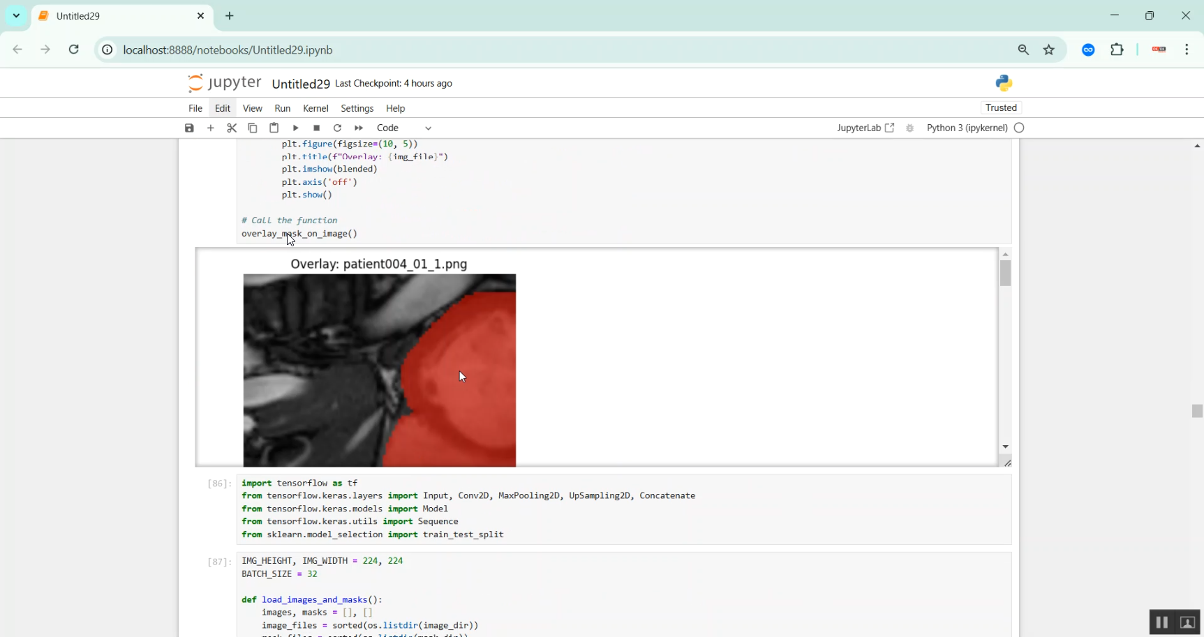 Cardiac Multi structure Segmentation using MRI Image in Python Projects