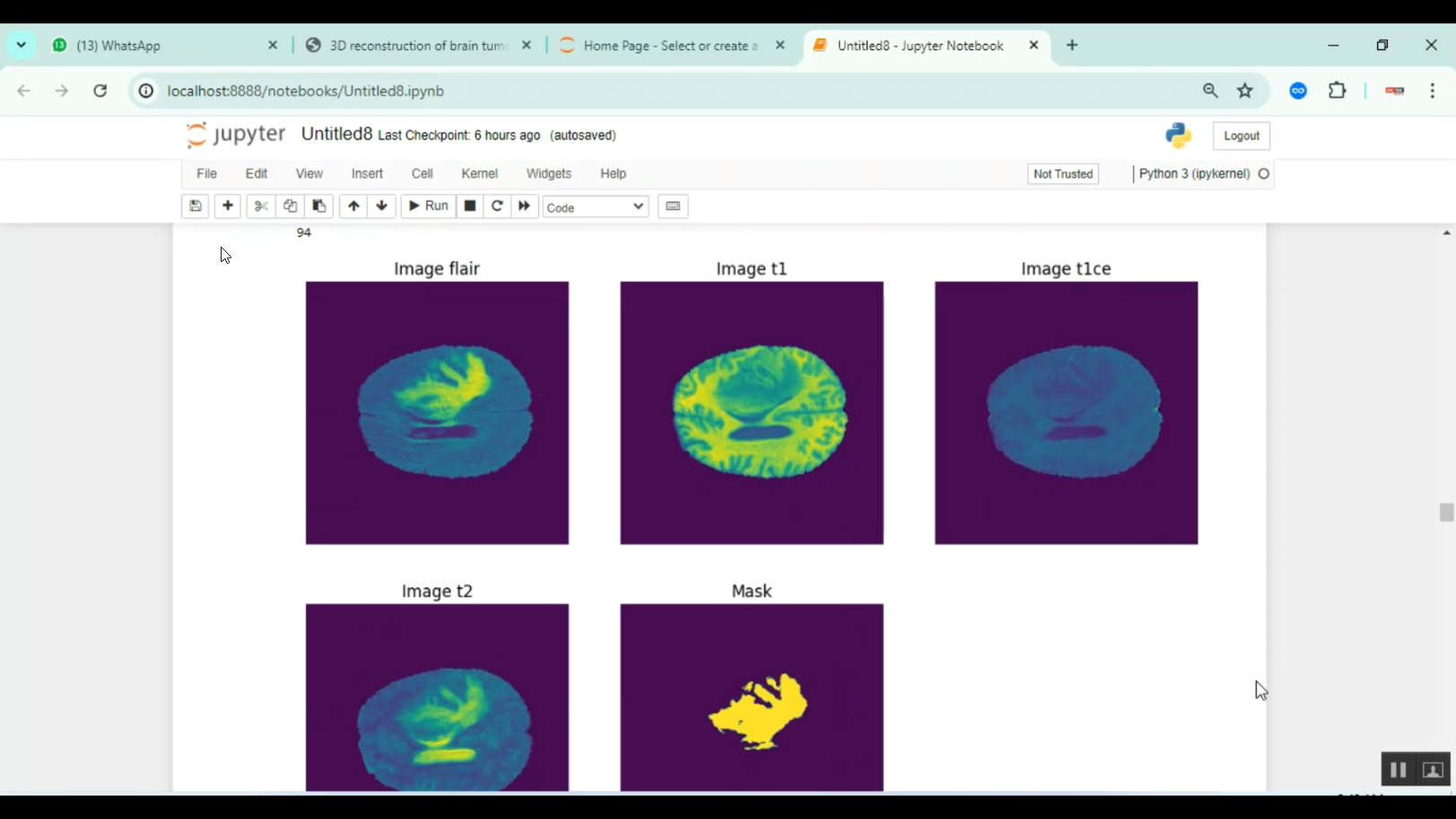 Brain Tumor Detection 2d 3d Image Classification in Python Projects
