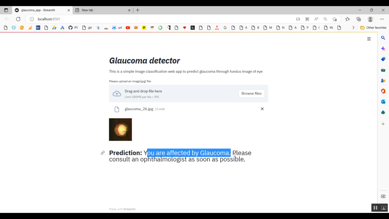 Glaucoma Disease Prediction Image Classification Streamlit in Python ...