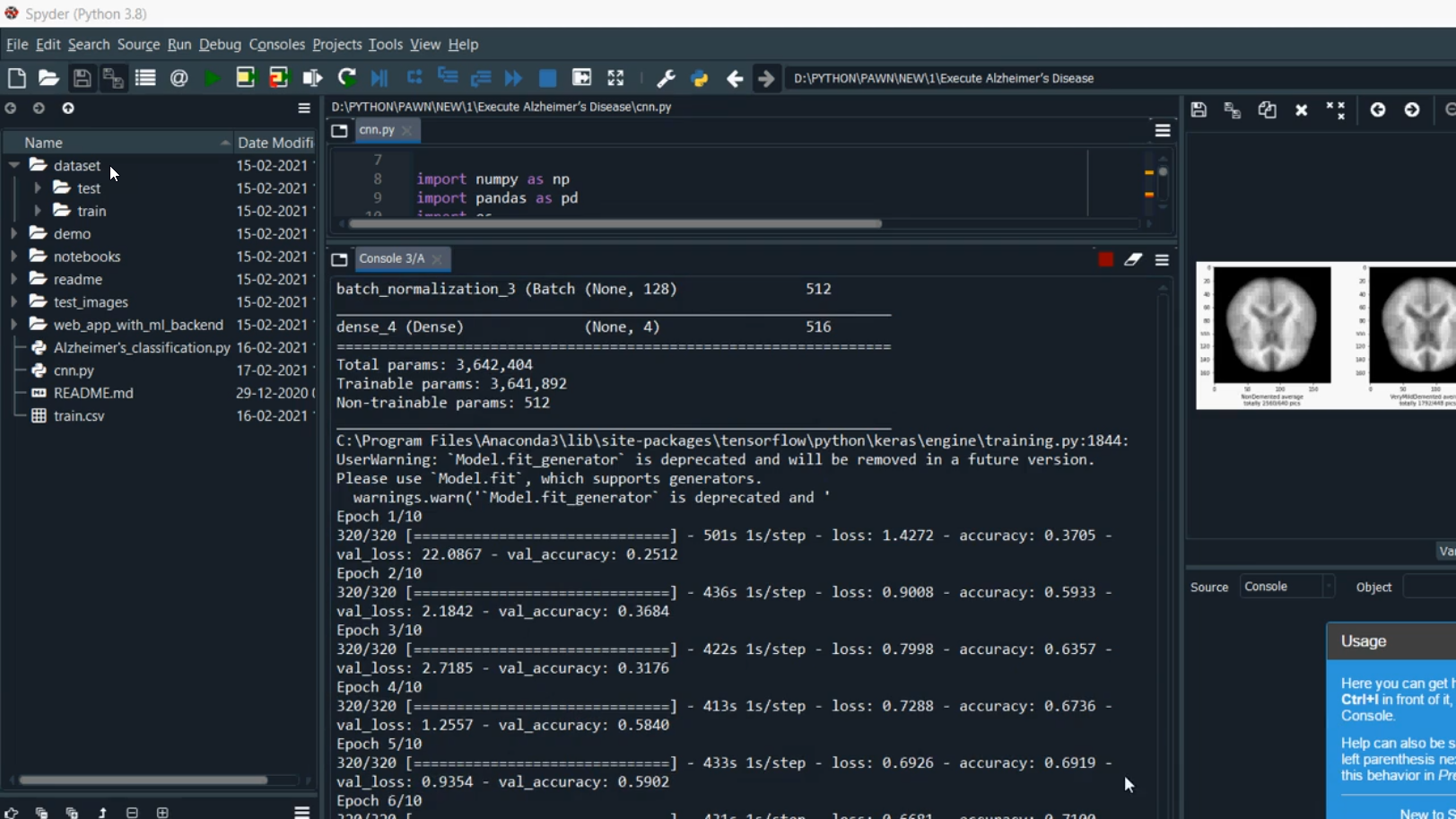 Alzheimer Early Detection CNN MLP in Python Projects