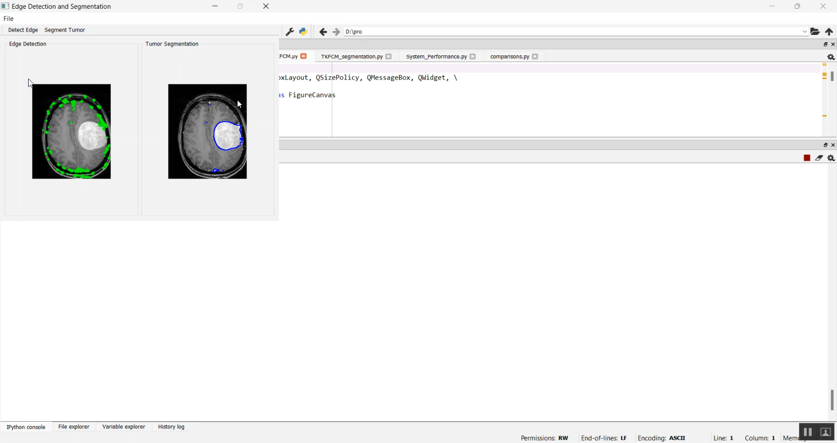 Brain Tumor Segmentation Using Simple CNN Console in Python Projects