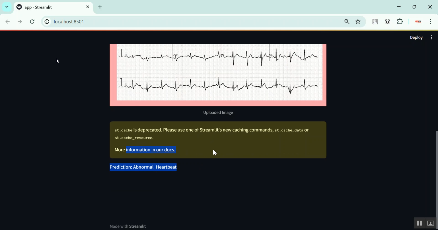 Cardiac Arrhythmia Classification in Python Projects
