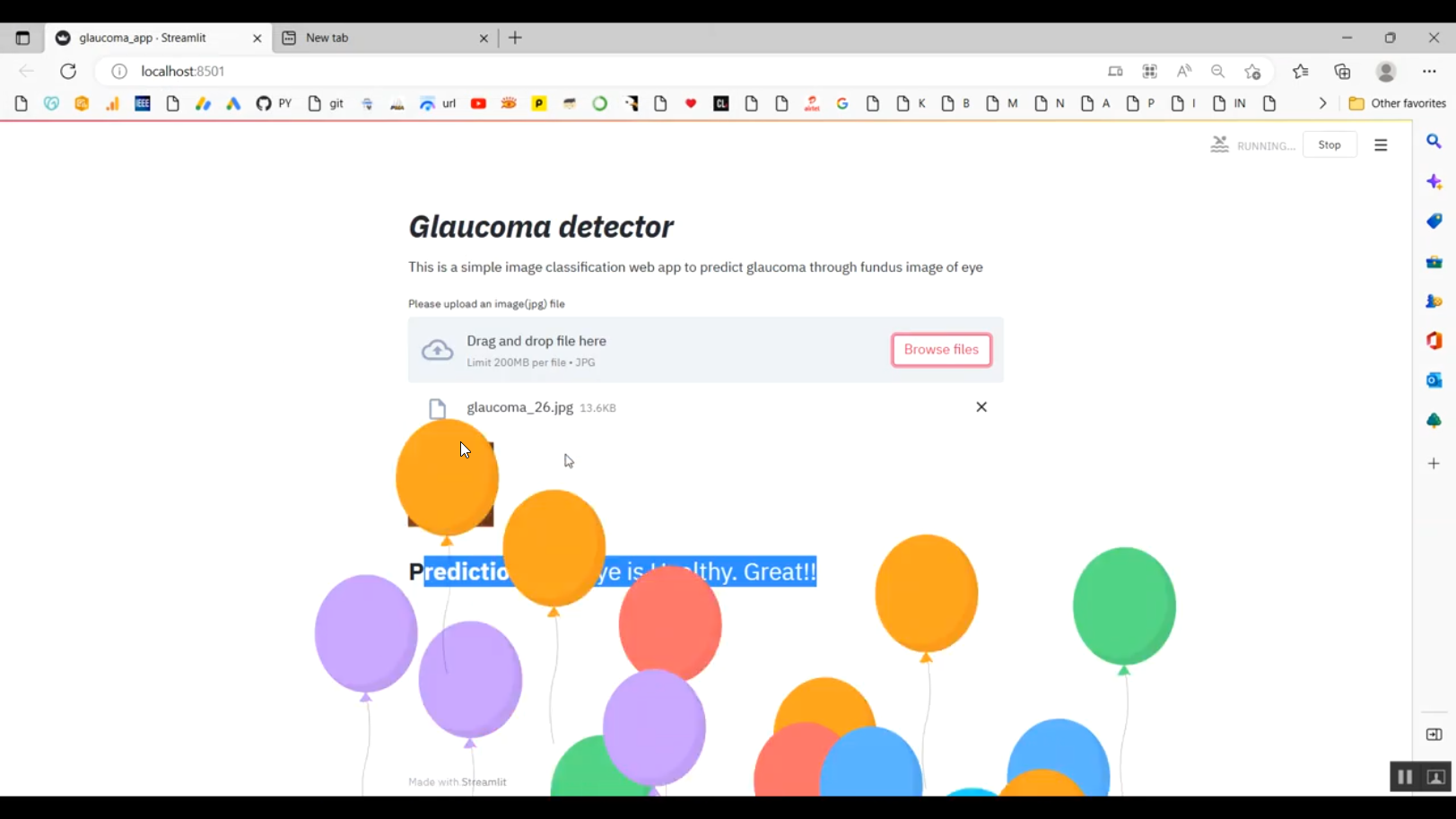 Glaucoma Disease Prediction Image Classification Streamlit in Python ...