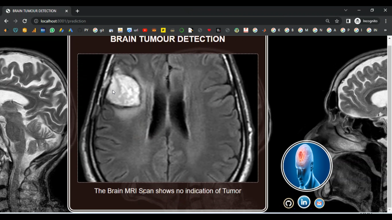 Brain Tumor CNN Image Segmentation in Python Projects