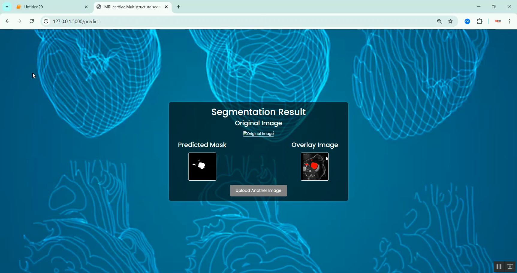 Cardiac Multi structure Segmentation using MRI Image in Python Projects