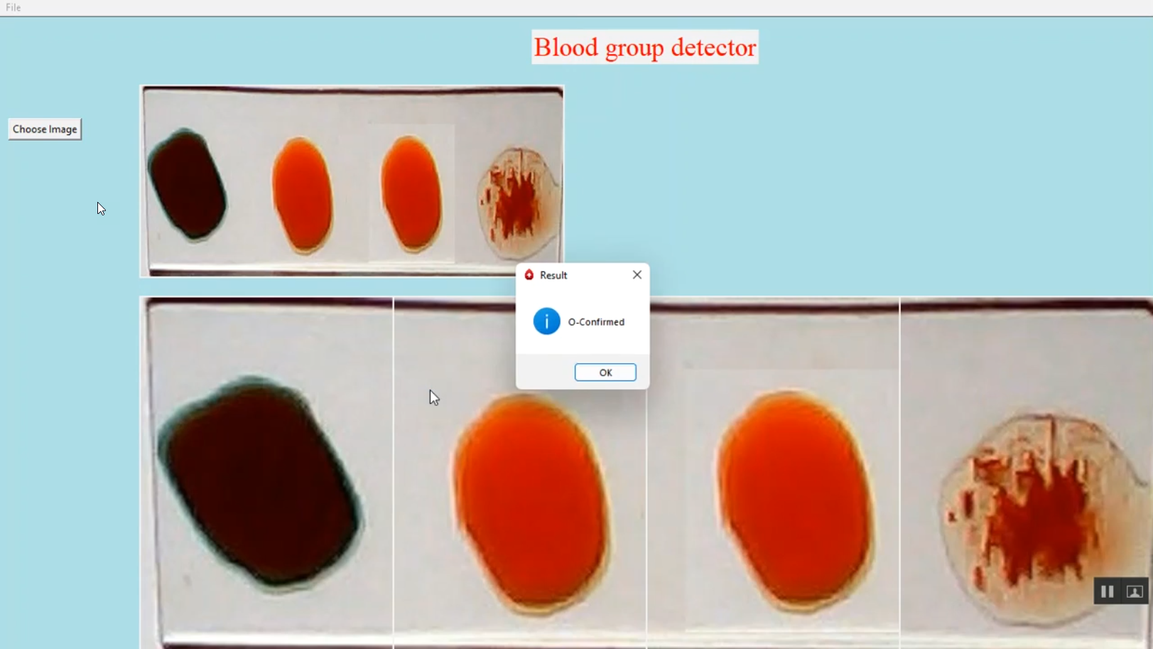 Blood Group Detection in Python Projects