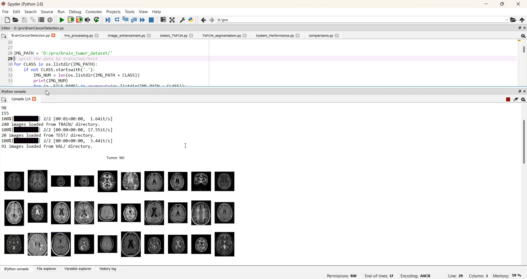 Brain Tumor Segmentation Using Simple CNN Console in Python Projects