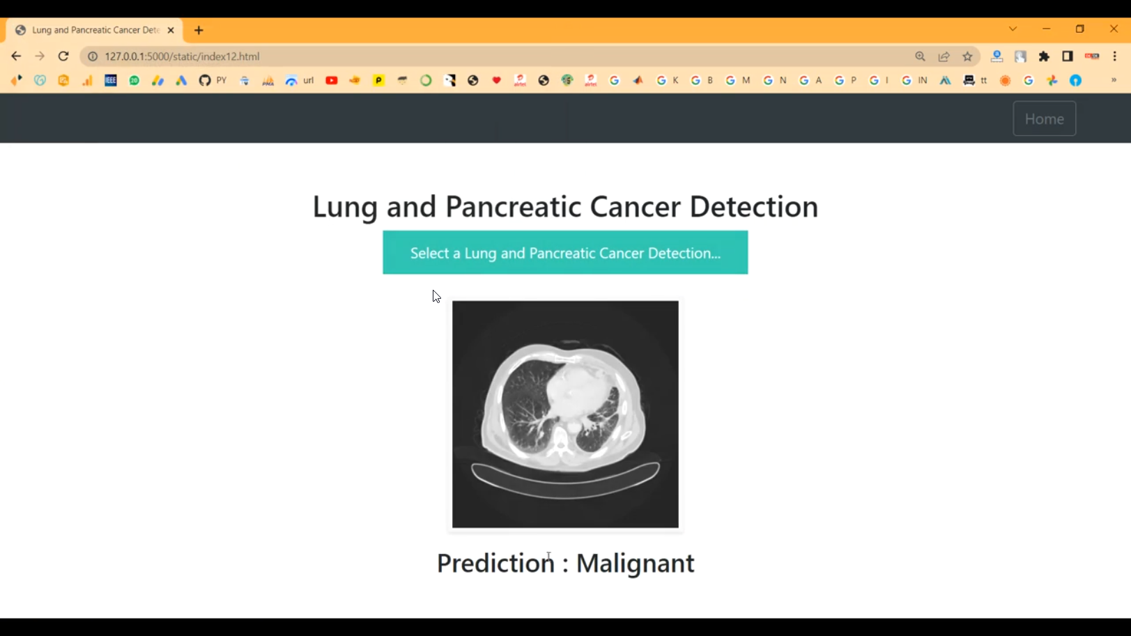 Lung Pancreatic Cancer CNN Train Flask App in Python Projects