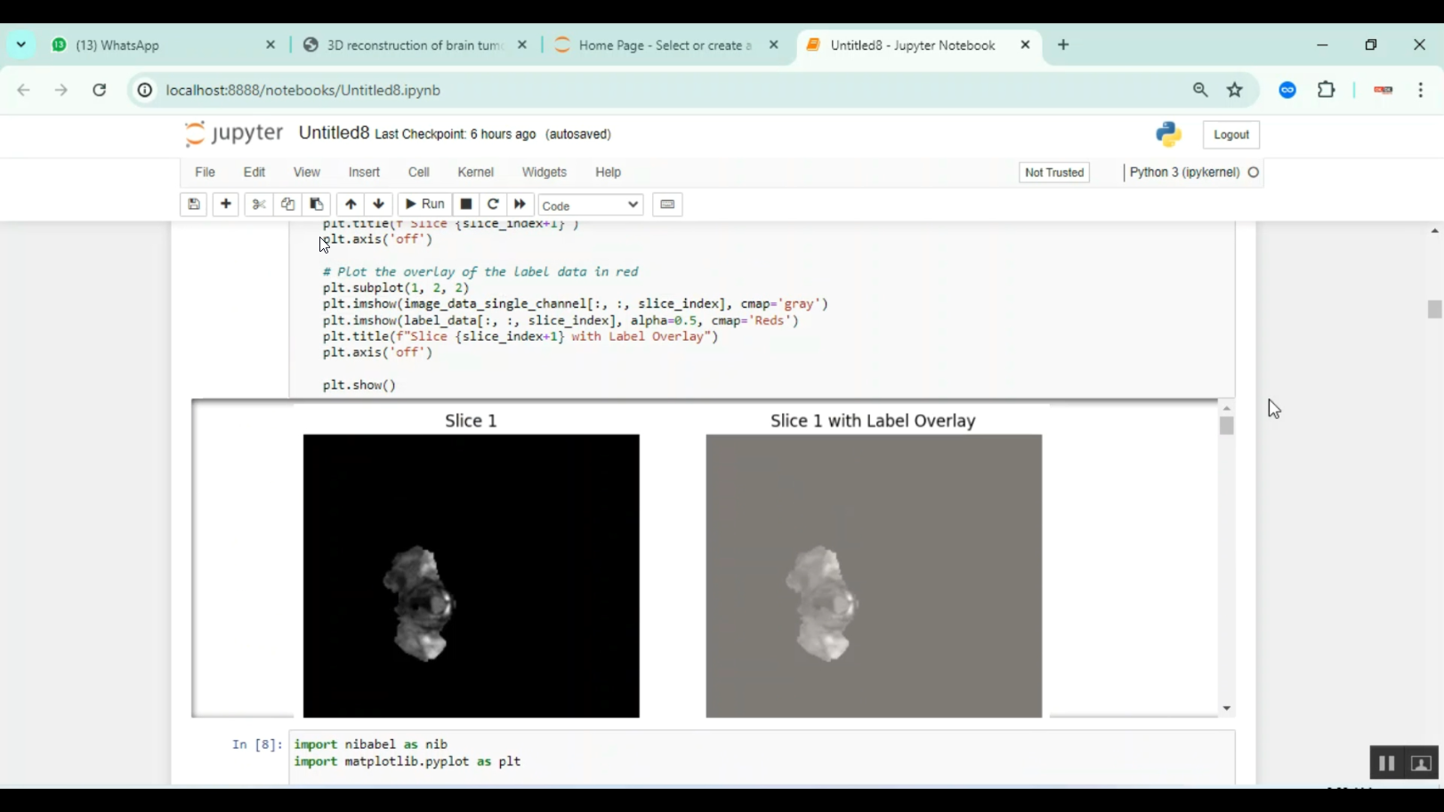 Brain Tumor Detection 2d 3d Image Classification in Python Projects