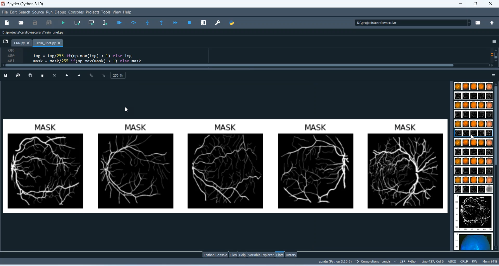 Cardiovascular Disease Classification in Python Projects