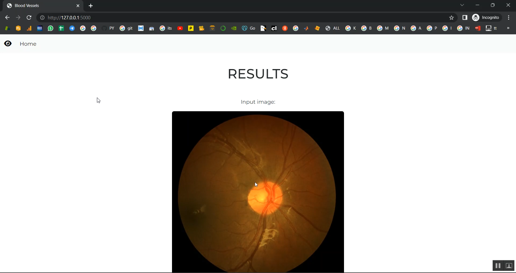 Retinal Vessel Image Analysis Jupyter Flask App in Python Projects