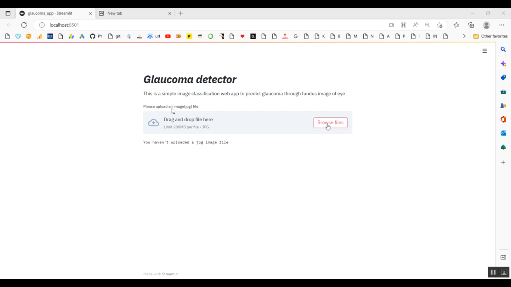 Glaucoma Disease Prediction Image Classification Streamlit in Python ...