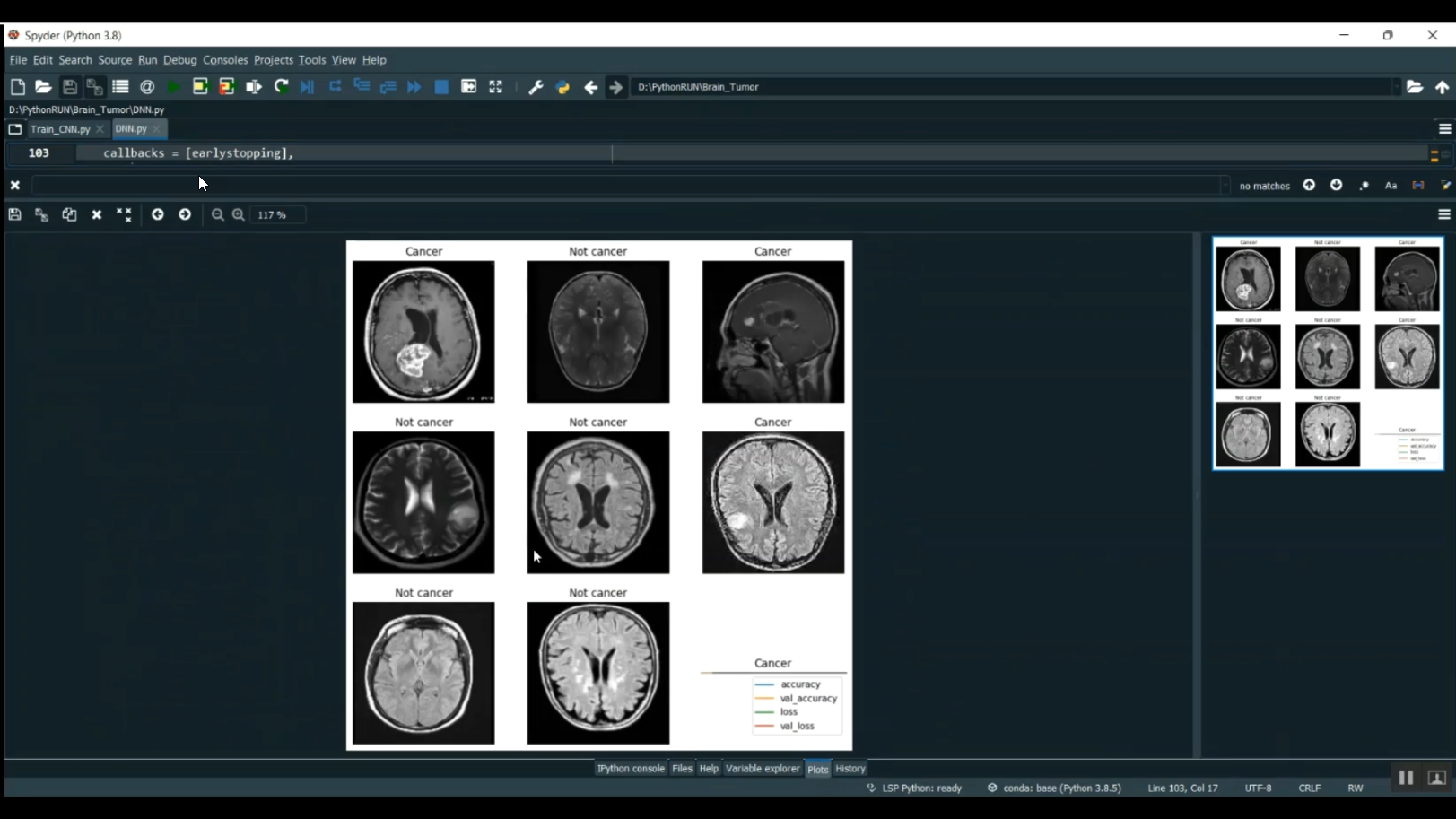 Brain Tumor CNN Image Segmentation in Python Projects