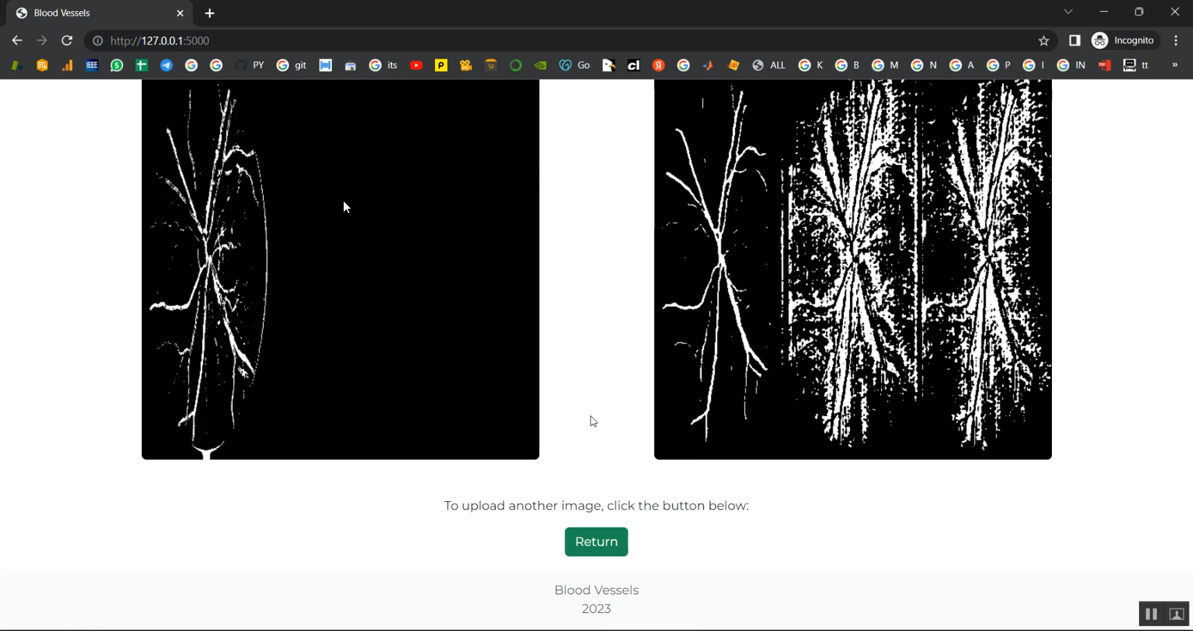 Retinal Vessel Image Analysis Jupyter Flask App in Python Projects